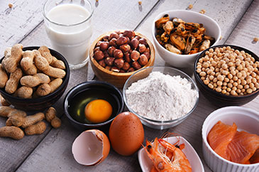 Food Allergy treatment services